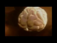 The-Developing-Teenage-Brain.mp4